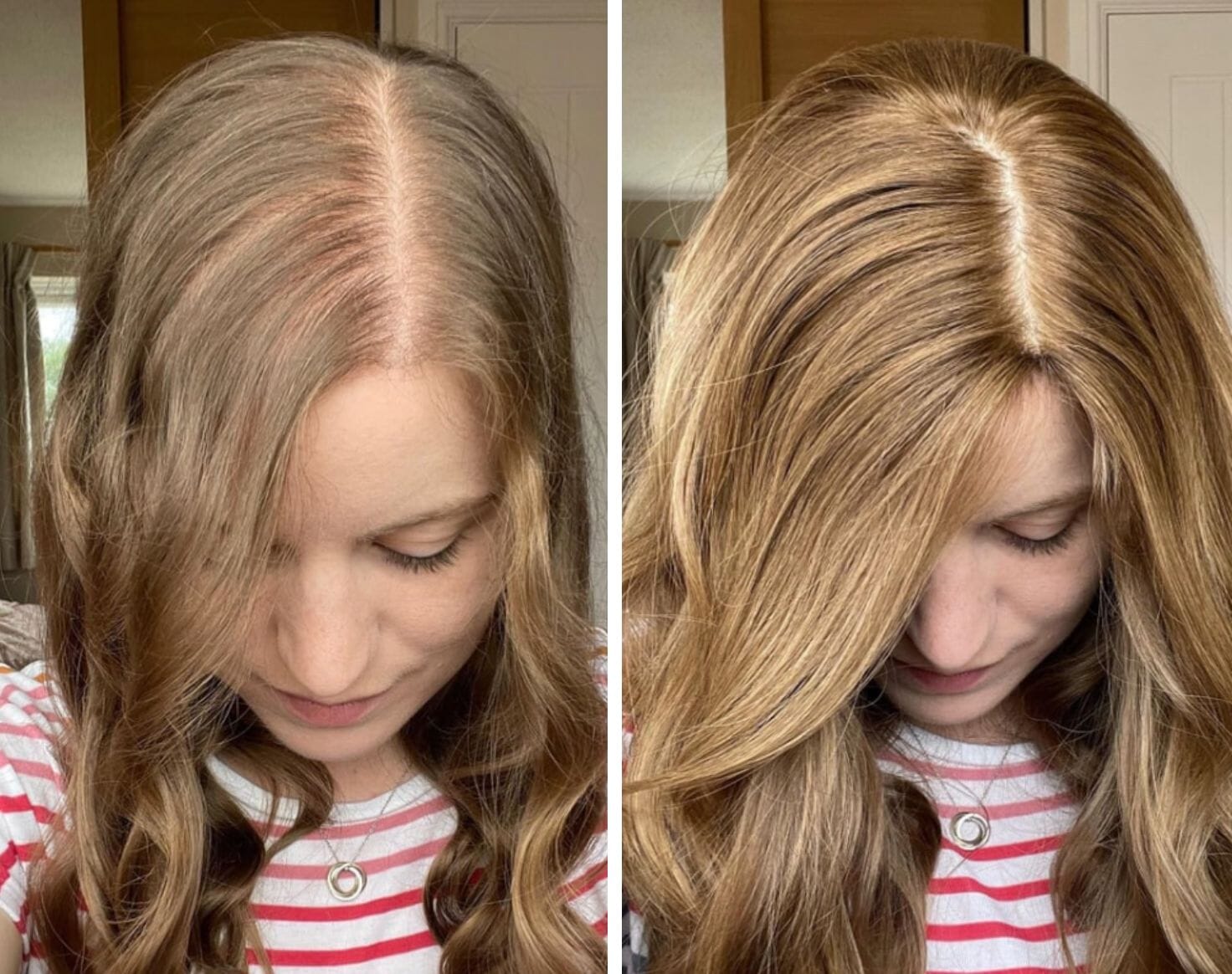 vitamins for healthy hair