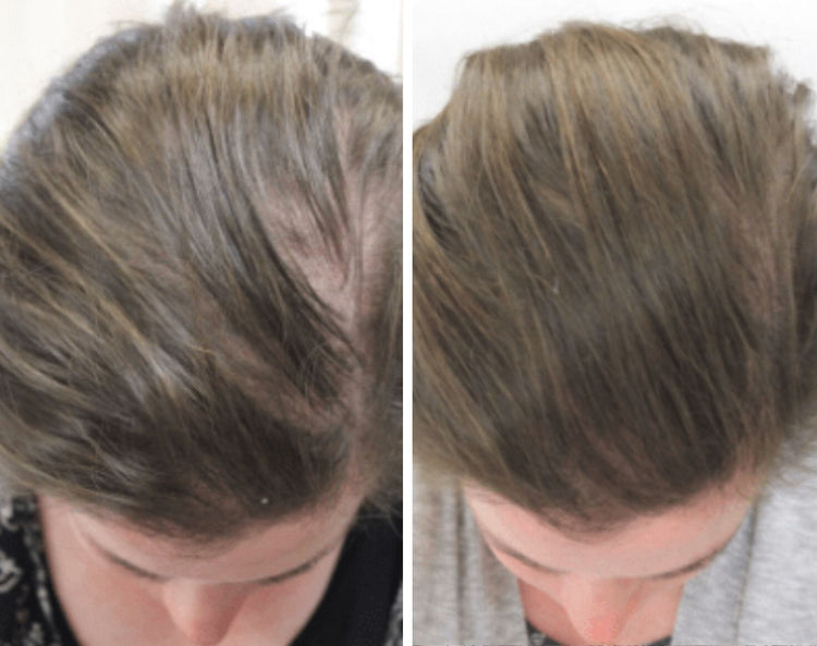 hair growth comparison